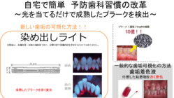 おうちで簡単に歯磨き習慣を身につける歯垢歯石検査ライト のトップ画像