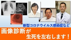 コンピュータ(AI)で医療現場での画像診断の精度向上に貢献したい！ のトップ画像