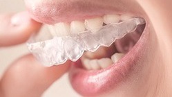 業界初の革新的なマウスピース型歯列矯正装置を世界に販売したい！ のトップ画像