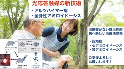 アルツハイマー病・全身性アミロイドーシスへの新薬開発にご支援を！ のトップ画像