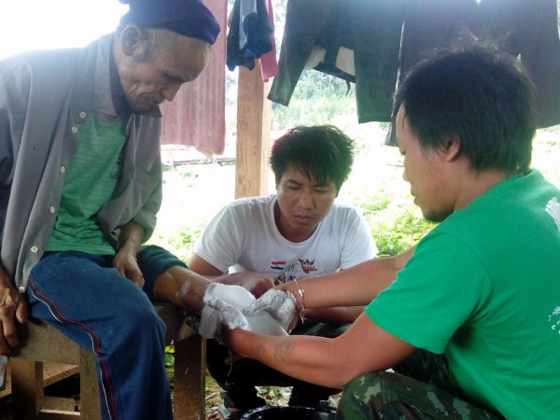 ミャンマー地雷被害者に初めての義足を。新しい一歩を共に！