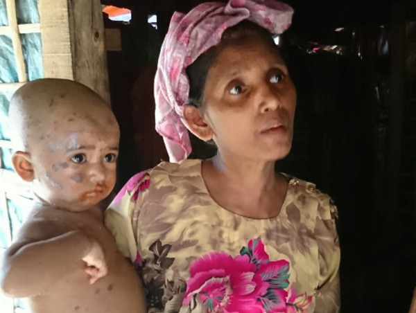 A17c9aaa61e80a1bf71d0d850af4e5baa9800bbd