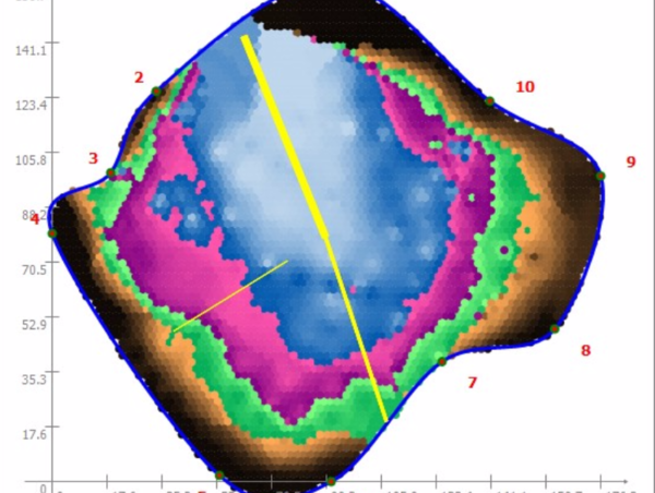 A17c9aaa61e80a1bf71d0d850af4e5baa9800bbd