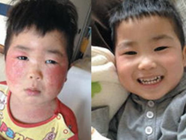 A17c9aaa61e80a1bf71d0d850af4e5baa9800bbd