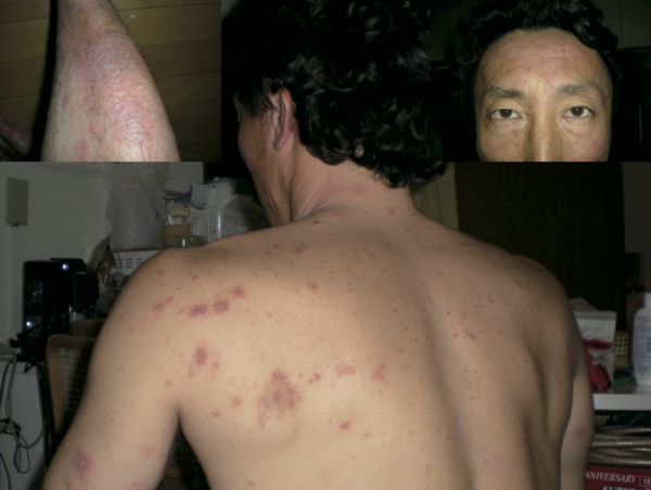 A17c9aaa61e80a1bf71d0d850af4e5baa9800bbd